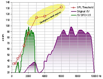 Quelle: Audiology Online